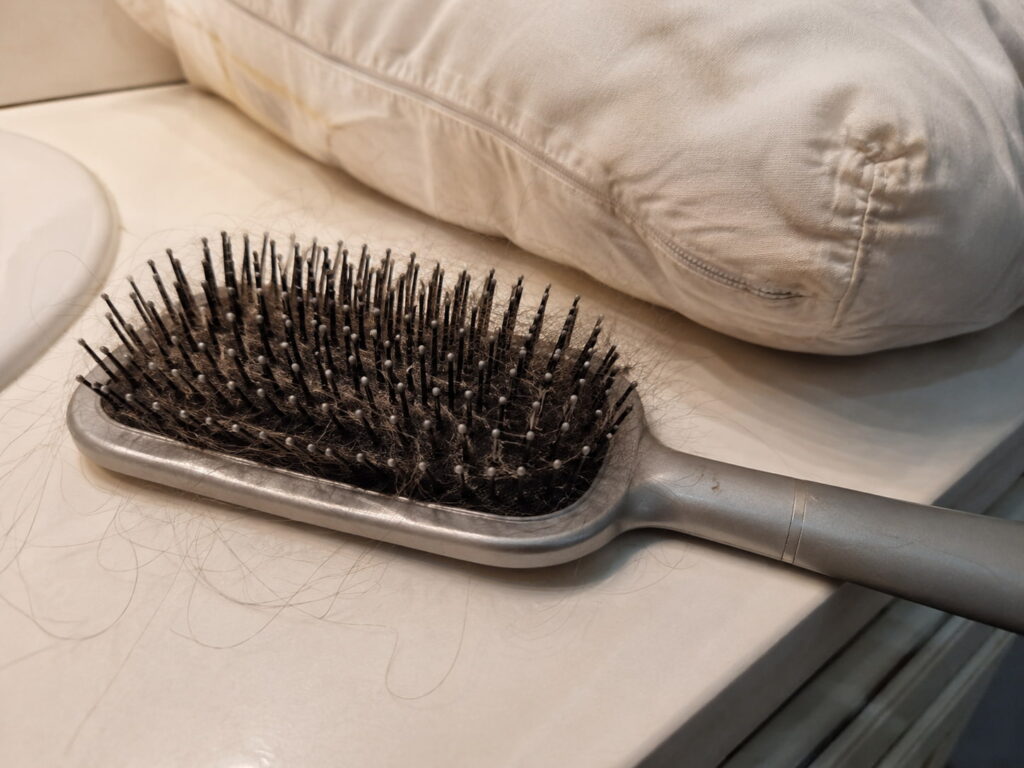 Dirty hairbrush with residue, a common cause of oily hair