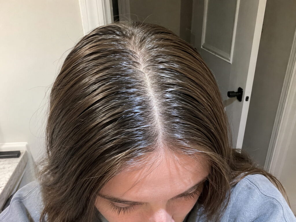 Close up of straight hair roots showing genetics linked oily hair