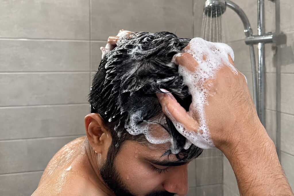 Man using medicated shampoo to treat dandruff and reduce hair loss