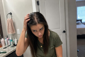 Close up of oily hair roots and greasy scalp shine