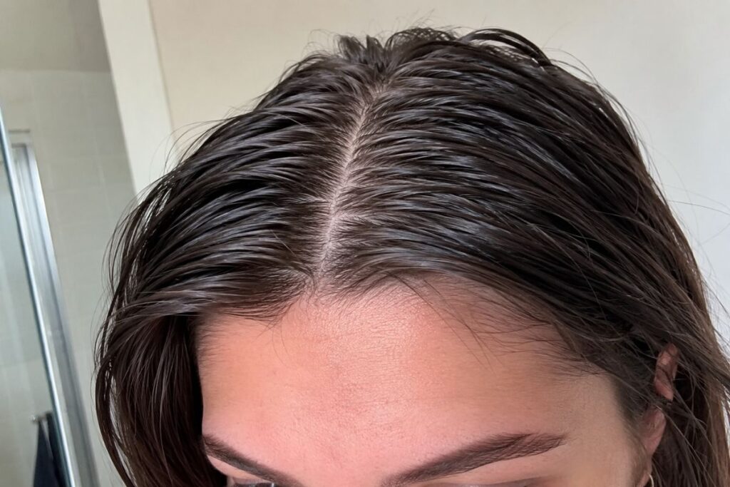 Oily scalp buildup from overusing coconut oil