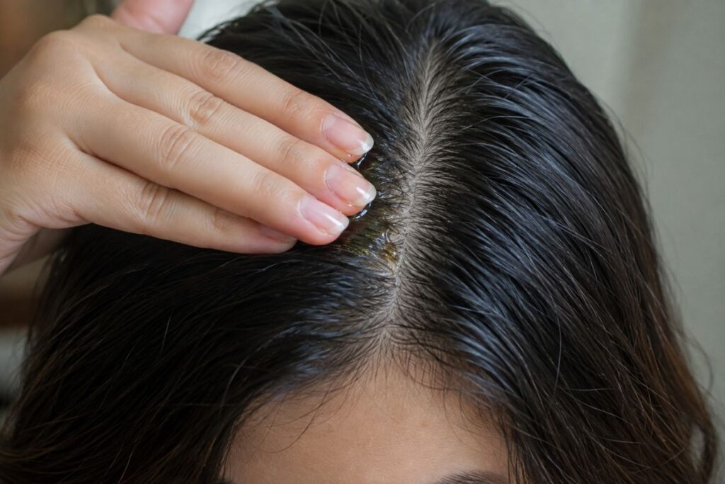 Natural oil remedy applied to dry scalp